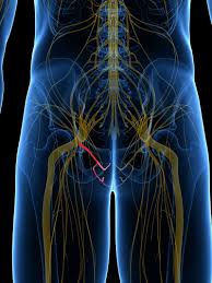 Understanding Cystocele