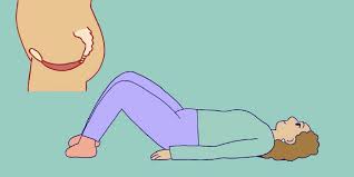 Muscle Relaxers for Pelvic Floor Dysfunction: A Comprehensive Guide - ProKegel