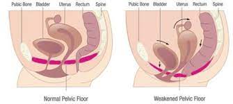 Understanding Female Pelvic Floor Muscles Anatomy - ProKegel